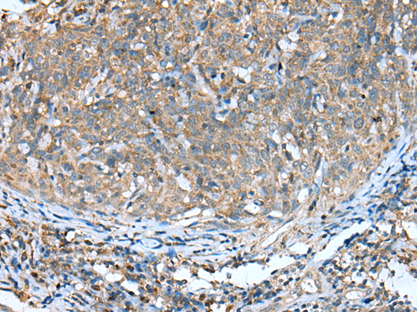 Anti-DCXR Rabbit Polyclonal Antibody