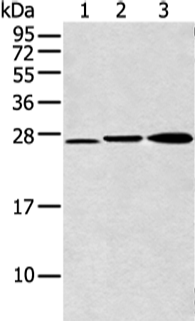 Anti-DCXR Rabbit Polyclonal Antibody