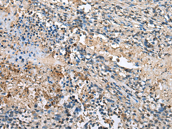 Anti-LMNTD1 Rabbit Polyclonal Antibody