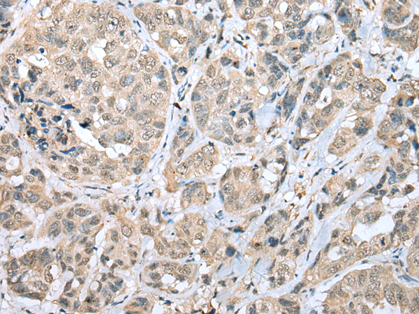 Anti-MPC1 Rabbit Polyclonal Antibody