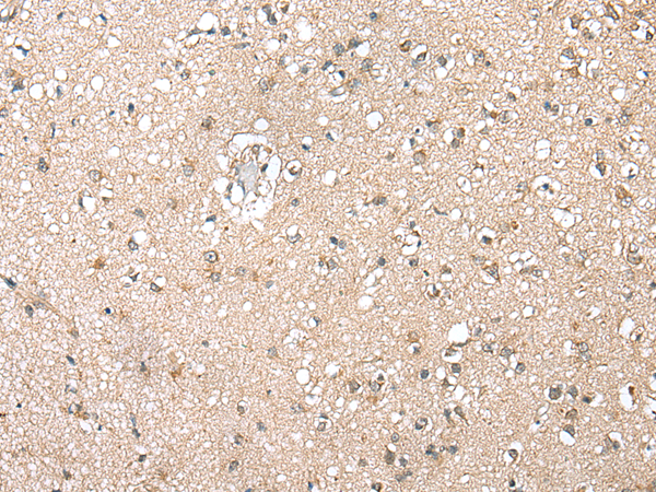 Anti-RPL35A Rabbit Polyclonal Antibody