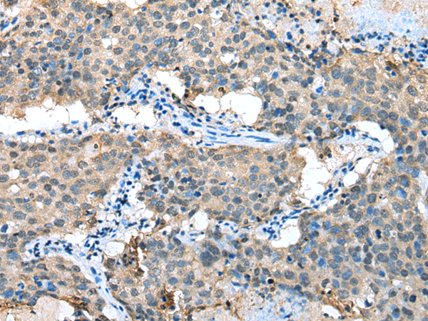 Anti-CCBL1 Rabbit Polyclonal Antibody