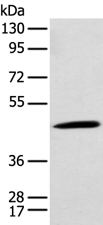 Anti-CCBL1 Rabbit Polyclonal Antibody