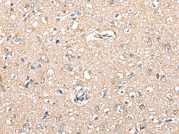 Anti-CART Rabbit Polyclonal Antibody