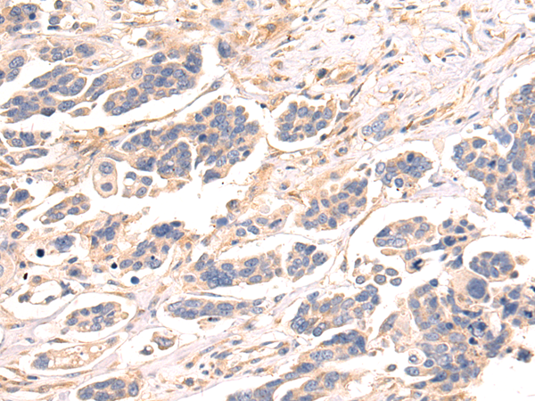 Anti-RPS15A Rabbit Polyclonal Antibody