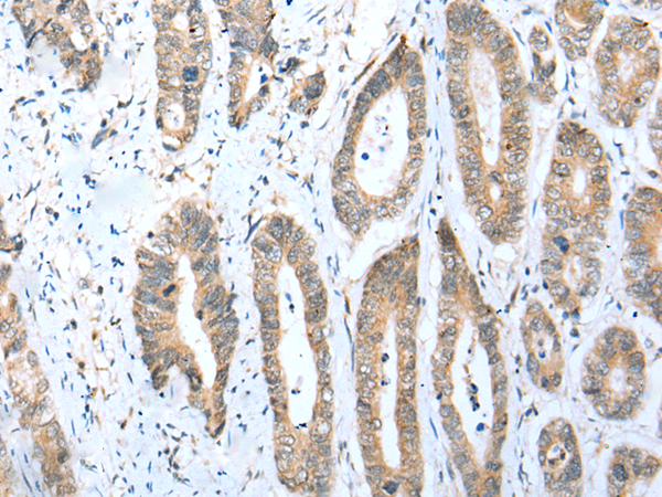 Anti-ACBD4 Rabbit Polyclonal Antibody