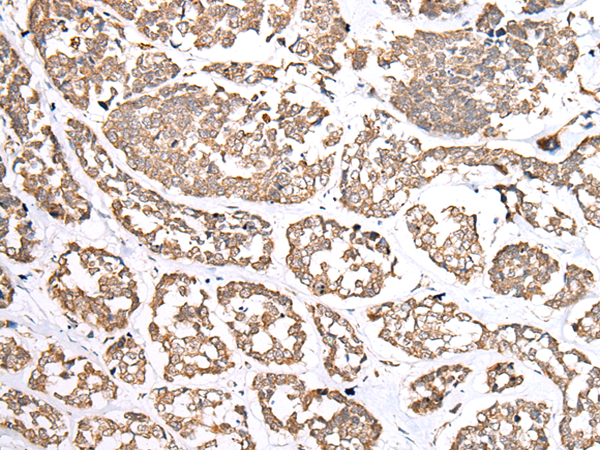 Anti-NDP Rabbit Polyclonal Antibody