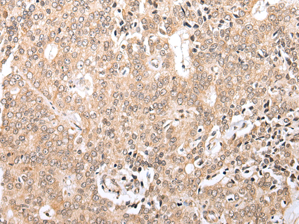 Anti-ZNF621 Rabbit Polyclonal Antibody