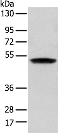 Anti-ZNF621 Rabbit Polyclonal Antibody