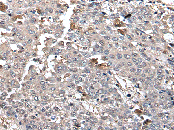 Anti-hnRNP H2 Rabbit Polyclonal Antibody