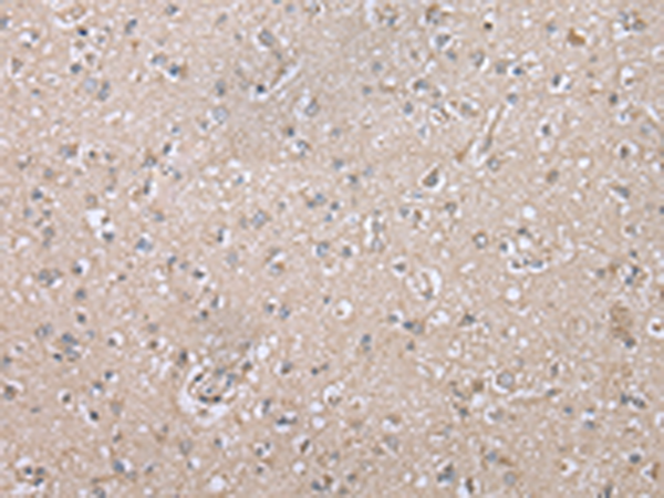 Anti-POMK Rabbit Polyclonal Antibody