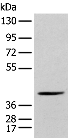 Anti-POMK Rabbit Polyclonal Antibody