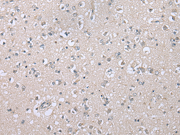 Anti-CDHR4 Rabbit Polyclonal Antibody