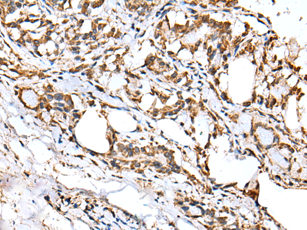 Anti-ITLN2 Rabbit Polyclonal Antibody