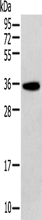 Anti-ITLN2 Rabbit Polyclonal Antibody