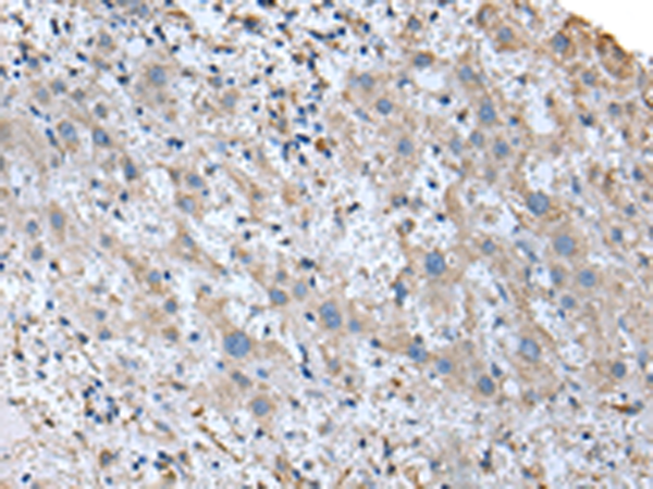 Anti-Ubiquitin Conjugating Enzyme E2 J2 Rabbit Polyclonal Antibody