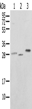 Anti-Ubiquitin Conjugating Enzyme E2 J2 Rabbit Polyclonal Antibody
