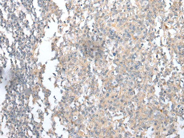 Anti-C8G Rabbit Polyclonal Antibody