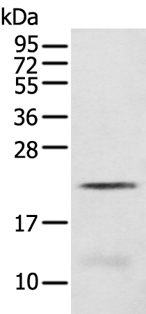 Anti-C8G Rabbit Polyclonal Antibody
