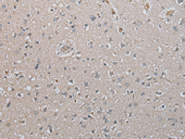 Anti-DAND5 Rabbit Polyclonal Antibody