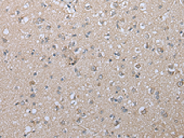 Anti-Radial Spoke Head 1 Homolog Rabbit Polyclonal Antibody