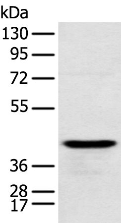 Anti-Radial Spoke Head 1 Homolog Rabbit Polyclonal Antibody