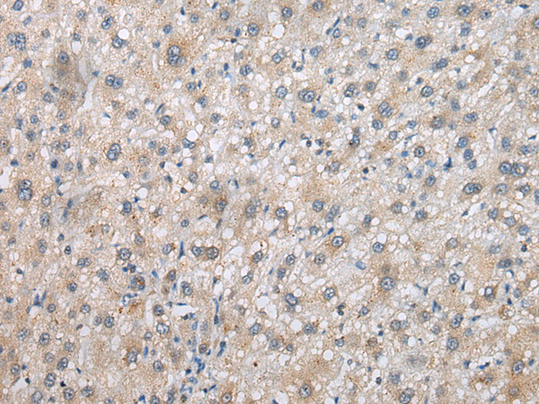 Anti-PSMF1 Rabbit Polyclonal Antibody