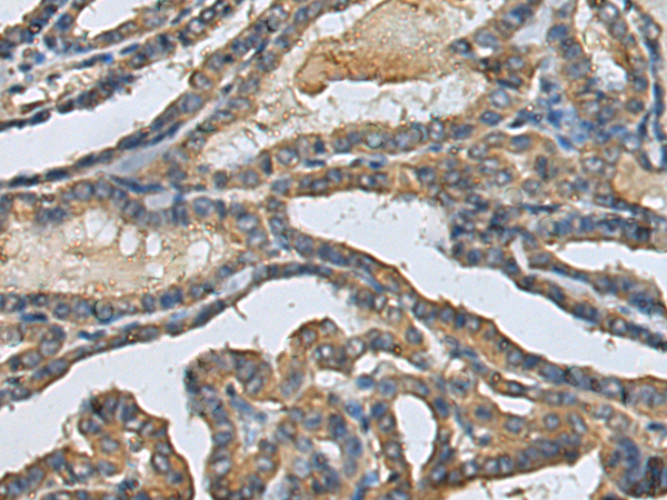 Anti-Rab41 Rabbit Polyclonal Antibody