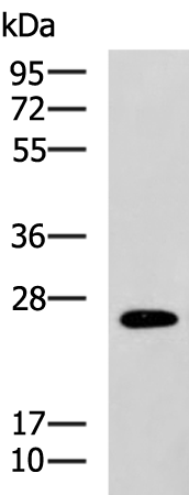 Anti-Rab41 Rabbit Polyclonal Antibody