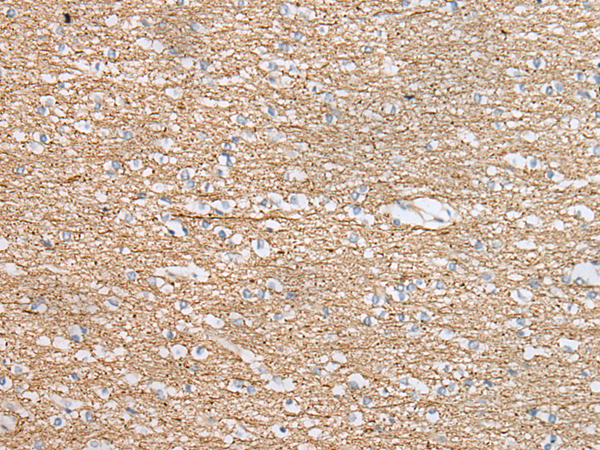 Anti-IDO 2 Rabbit Polyclonal Antibody