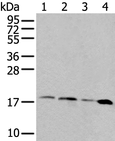 Anti-RPS15 Rabbit Polyclonal Antibody