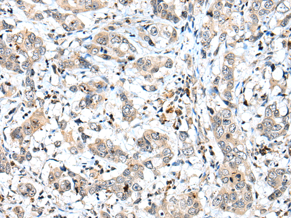 Anti-SPCS2 Rabbit Polyclonal Antibody