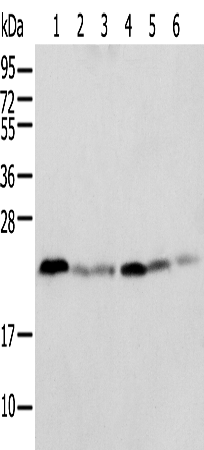 Anti-SPCS2 Rabbit Polyclonal Antibody