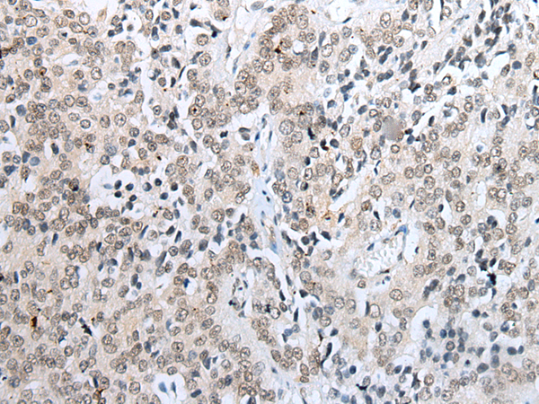 Anti-NUDT21 Rabbit Polyclonal Antibody