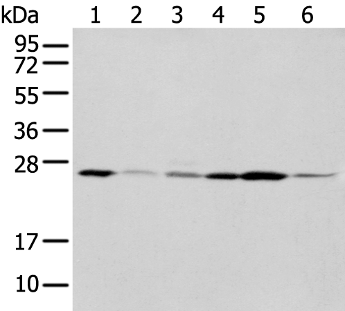 Anti-NUDT21 Rabbit Polyclonal Antibody