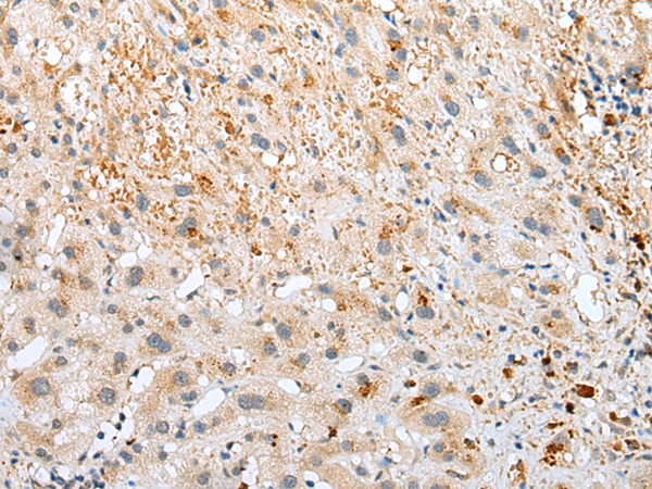 Anti-NUDT6 Rabbit Polyclonal Antibody
