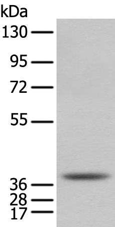 Anti-NUDT6 Rabbit Polyclonal Antibody