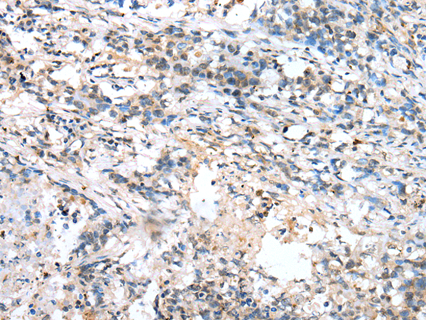Anti-NUDT2 Rabbit Polyclonal Antibody