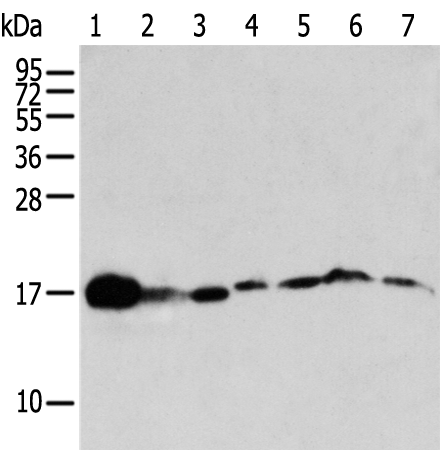 Anti-NUDT2 Rabbit Polyclonal Antibody