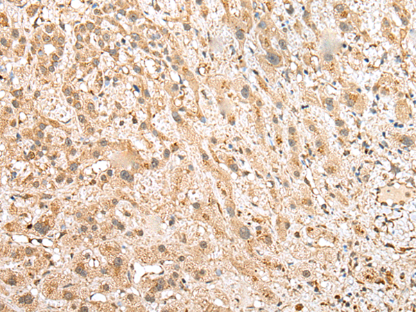 Anti-NUDT12 Rabbit Polyclonal Antibody