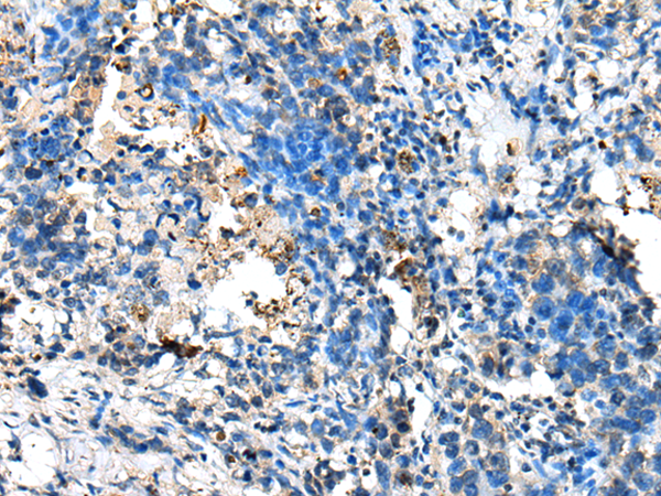 Anti-NUDT10 Rabbit Polyclonal Antibody