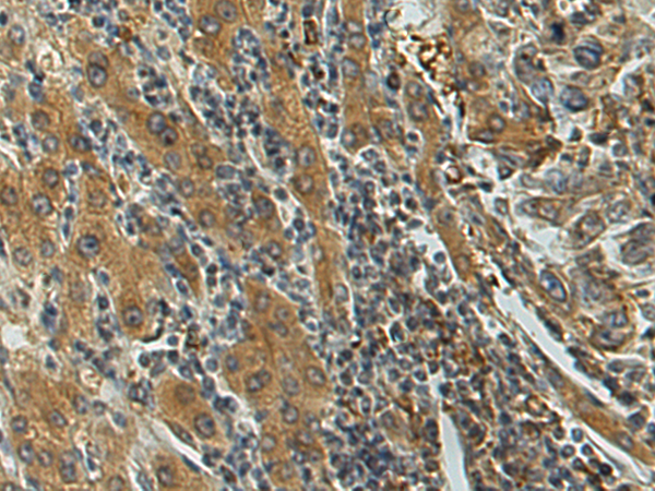 Anti-GSTM2 Rabbit Polyclonal Antibody