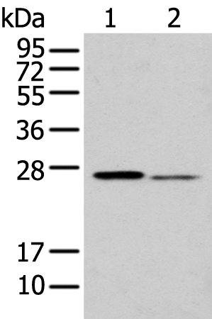 Anti-GSTM2 Rabbit Polyclonal Antibody