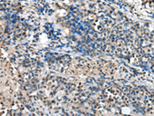 Anti-C1QTNF3 Rabbit Polyclonal Antibody