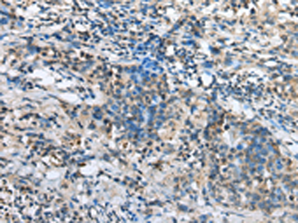 Anti-NDUFA12 Rabbit Polyclonal Antibody