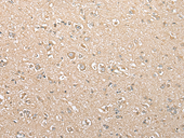 Anti-USE1 Rabbit Polyclonal Antibody