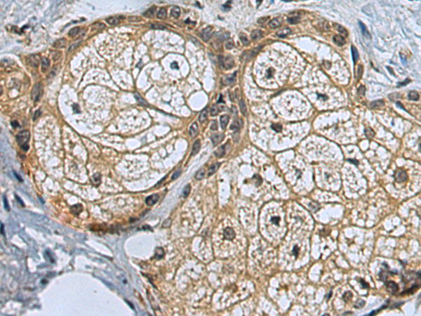 Anti-Cardiac Troponin C Rabbit Polyclonal Antibody