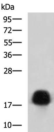 Anti-Cardiac Troponin C Rabbit Polyclonal Antibody