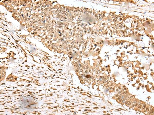 Anti-eEF1E1 Rabbit Polyclonal Antibody