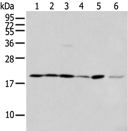 Anti-eEF1E1 Rabbit Polyclonal Antibody
